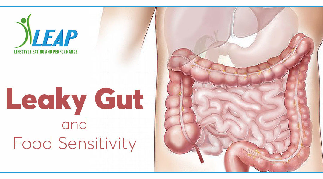 Leaky Gut and Food Sensitivity